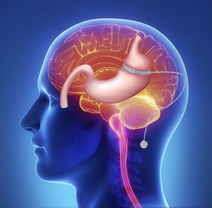 Reducción de estomago Valencia por hipnosis Reducción de estomago Valencia por hipnosis